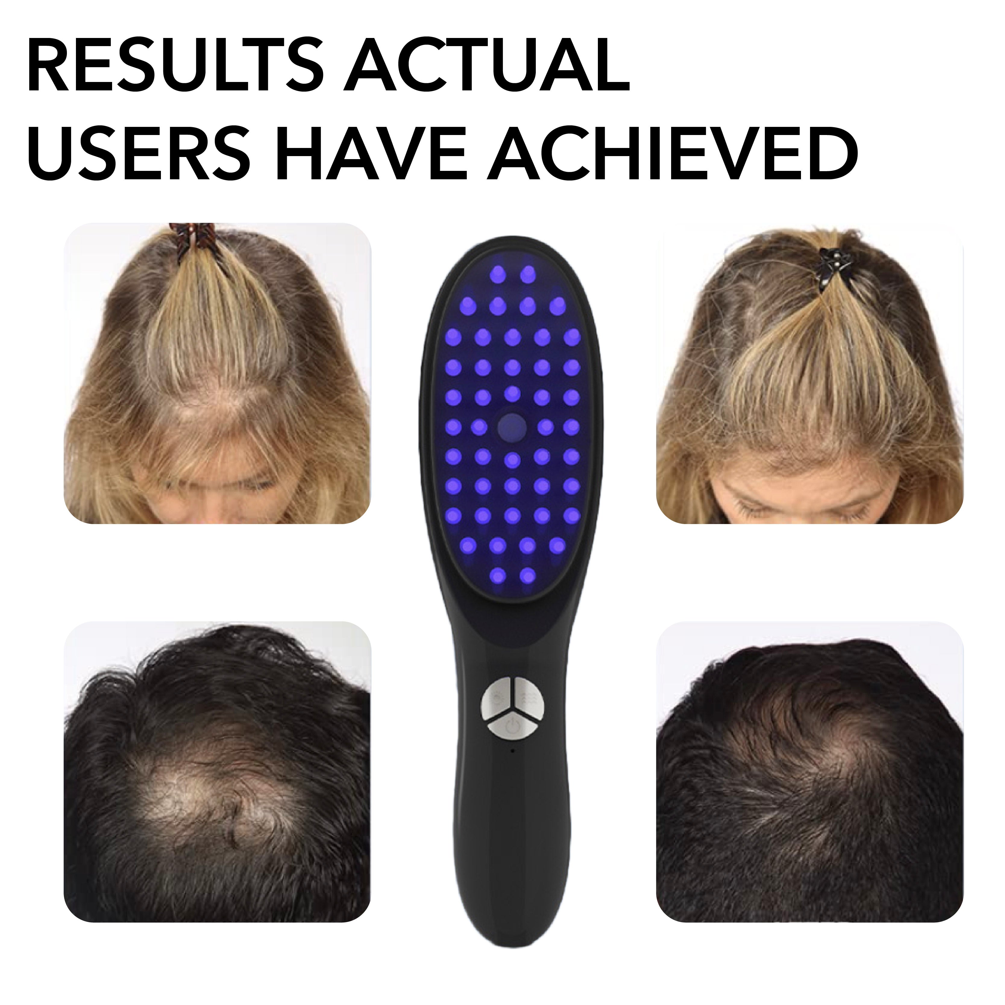 Peigne Laser EMS Favorisant la Repousse des Cheveux