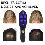 Peigne Laser EMS Favorisant la Repousse des Cheveux